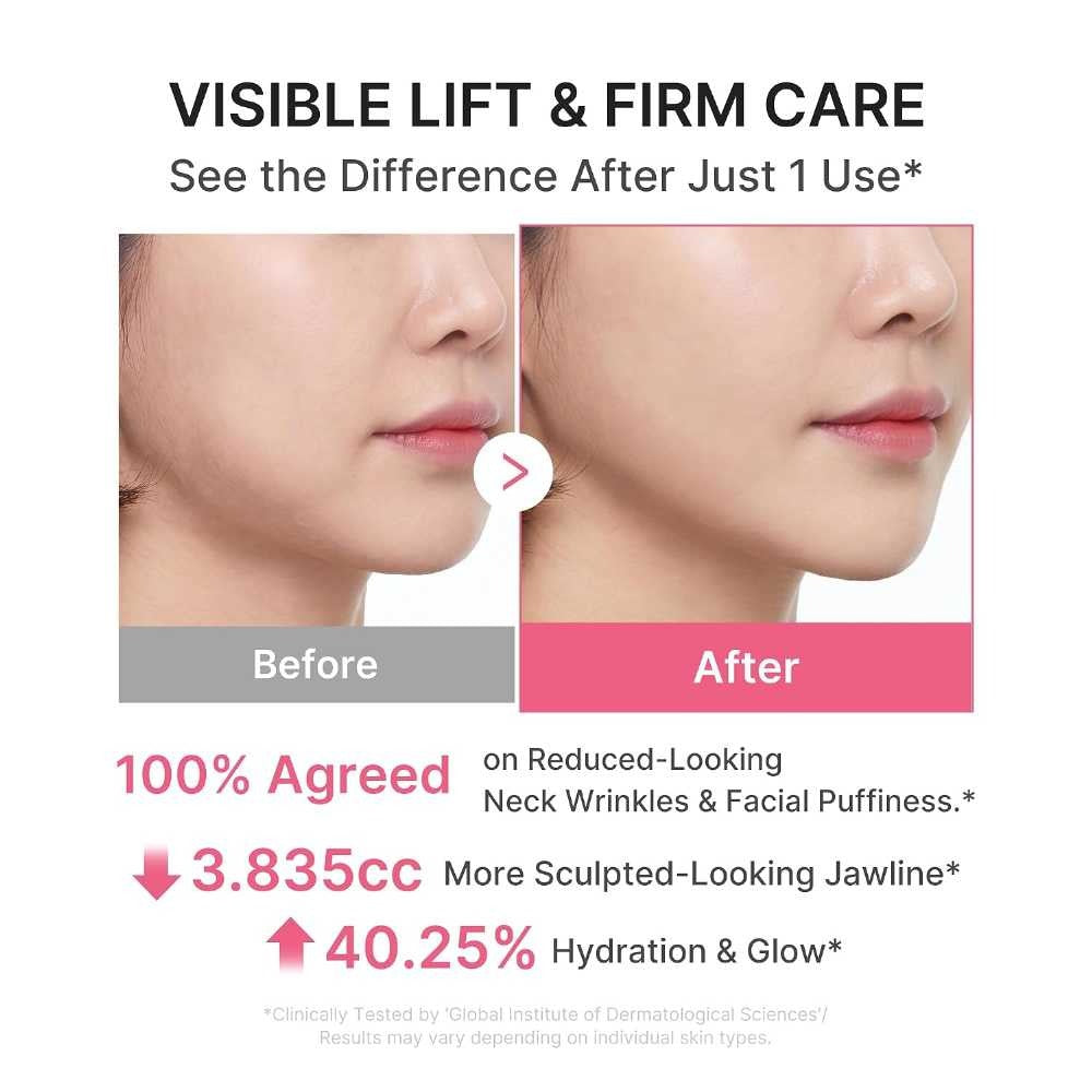 Medicube Neck Wrinkle Cream – كريم مضاد لتجاعيد الرقبة لشد وترطيب البشرة