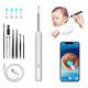 1080P HD Smart Earwax Removal Kit – Safe & Easy Cleaning
