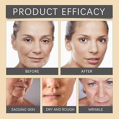 OUHOE Bee Venom Wrinkle Cream – كريم سم النحل لمظهر أصغر سناً وبشرة أكثر نعومة