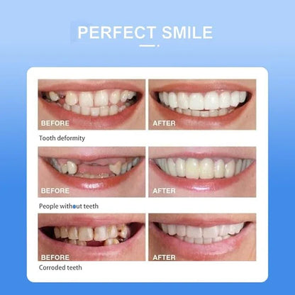 Removable White Teeth Veneers Covers Gaps, Yellow, Missing & Crooked Teeth - One Size Fits All, No Dentist Needed